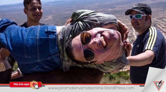 El hombre brasileño que nació con la cabeza al revés da positivo a covid